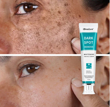 Détachant Taches Foncées